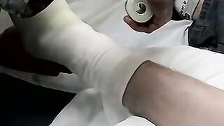 Foot cast placed on twink and his leg before being taken off