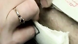 Foot cast placed on twink and his leg before being taken off