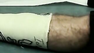 Foot cast placed on twink and his leg before being taken off