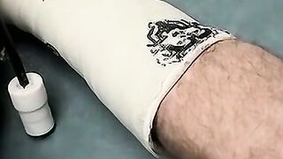 Foot cast placed on twink and his leg before being taken off