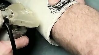 Foot cast placed on twink and his leg before being taken off