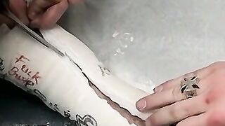 Foot cast placed on twink and his leg before being taken off
