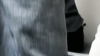 Foot cast placed on twink and his leg before being taken off