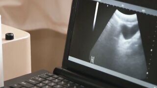 Sucractuting Hot Twink Ass Tall Doctor Fingers Petite Boys Prostate in SlowMo Carnal Tease!