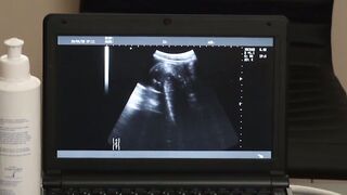 UNBELIEVABLE DOCTORS SECRET Petite Twinks Most Epic Bareback RIDE of His Life!
