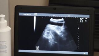 UNBELIEVABLE DOCTORS SECRET Petite Twinks Most Epic Bareback RIDE of His Life!