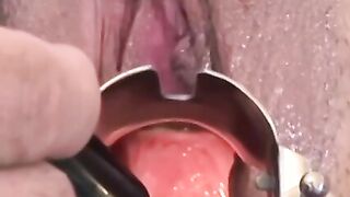 "Doctor's Orders - Spread Eagle Creampie"