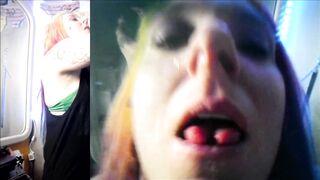 Vore Endoscopy