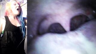 Vore Endoscopy