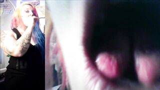 Vore Endoscopy