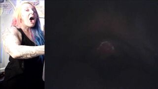 Vore Endoscopy