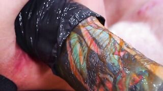 Anal Prolapse Extreme Fisting with Anal Gaping by Alexis Texas & Sean Michaels