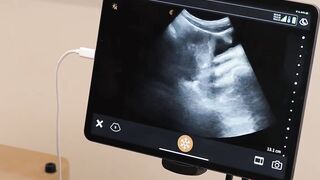 Petite Patient's Pussy Gets Ultra-Sound Examination By Hunk Doctor