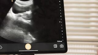 Hot Doctor's Anal Examination - Medical Roleplay