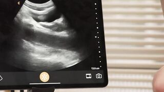 Hot Doctor's Anal Examination - Medical Roleplay