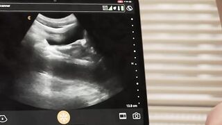 Hot Doctor's Anal Examination - Medical Roleplay