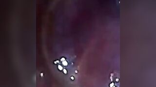 Endoscope POV: Test Tube Cock Urethral Insertion