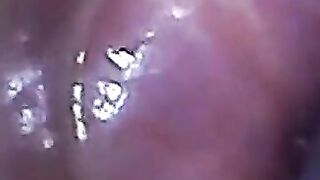 Endoscope POV: Test Tube Cock Urethral Insertion