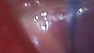 Endoscope POV: Test Tube Cock Urethral Insertion
