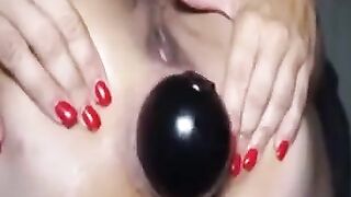 Amateur Anal Fisting