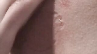 Nice tits get tormented 2