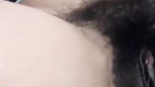 Hairy Milf Anal on Webcam