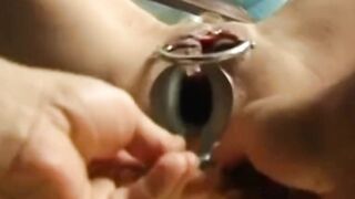 German granny Romy tied, fisted and anal proofed