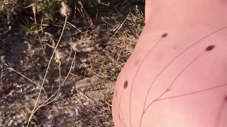 Outdoor Beach Exposure - Nude Woman Suffers from anal Prolapsis