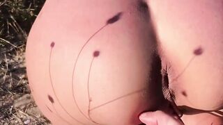 Outdoor Beach Exposure - Nude Woman Suffers from anal Prolapsis